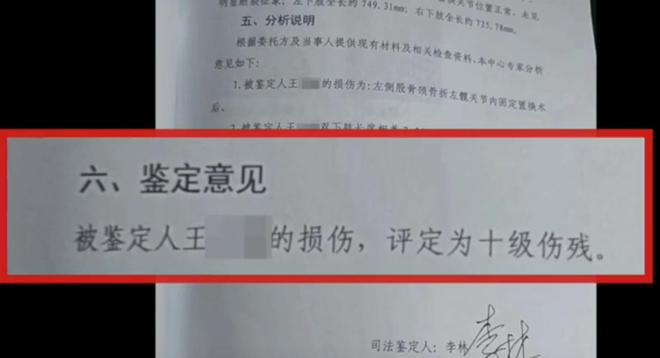 十级伤残鉴定标准